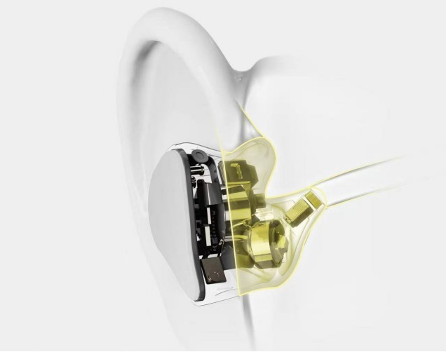 ���Ɵo�����C�l���ߡ��� �ǻۣ��Լ��g����+118헌����ډ������I�ИI�·�ʽ